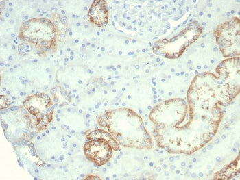 IHC staining of FFPE human kidney tissue with recombinant CDH16 antibody (clone rCDH16/7342) at 2ug/