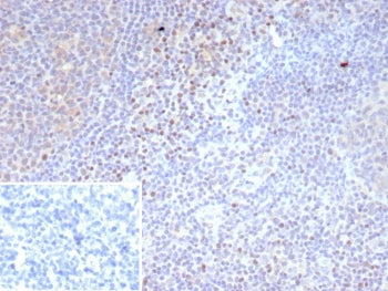 LEF1 Antibody / Lymphoid enhancer-binding factor 1 / TCF1 alpha