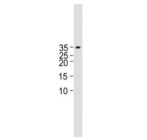 Western blot testing of human placental tissue lysate with Choriogonadotropin beta antibody. Predict