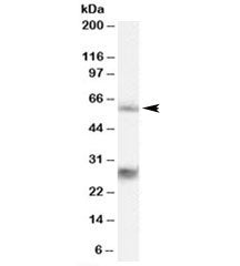 Western blot testing of 293 lysate with MPP6 antibody at 0.3ug/ml. The expected ~60kDa band and the 