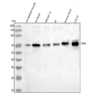 Western blot analysis of SYNC using anti-SYNC antibody. Lane 1: rat skeletal muscle tissue lysates, 