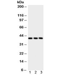 Western blot testing of human 1) placenta, 2) A549 and 3) HepG2 lysate with PTGER2 antibody. Expecte