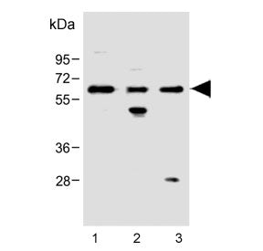 Western blot testing of human 1) CCRF-CEM, 2) ThP-1 and 3) HeLa cell lysate with FCGR1B antibody. Pr