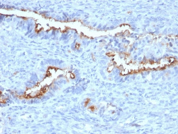 IHC staining of FFPE human endometrium with Podocalyxin antibody (clone PODXL/2184). HIER: boil tiss