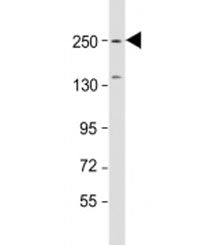SPTBN1 Antibody / Spectrin beta chain