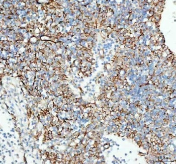 TACI Antibody / Transmembrane activator and CAML interactor