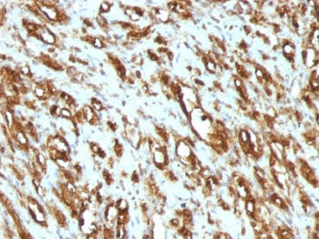 Actin Antibody (pan muscle)