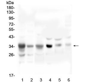 SFRP1 Antibody