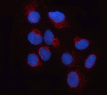 Immunofluorescent staining of FFPE human U-2 OS cells with Dynamin-like 120 kDa protein antibody (re