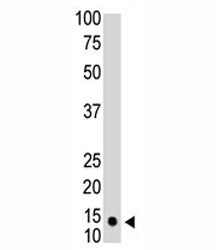 SUMO1 Antibody