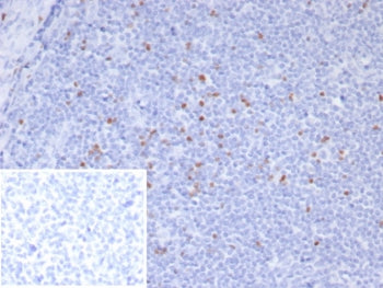 FOXP3 Antibody / Scurfin