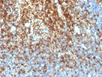 CD43 Antibody