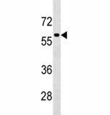 TFEB Antibody