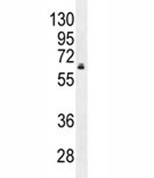 HNF1B antibody western blot analysis in MDA-MB231 lysate. Predicted molecular weight ~ 61 kDa.