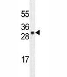 UBTD1 Antibody