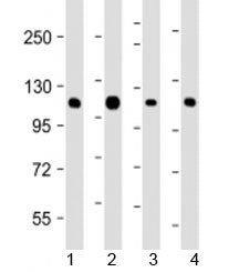 CBL Antibody / Casitas B-lineage lymphoma proto-oncogene