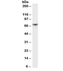 Western blot testing of rat brain lysate with PAK1 antibody at 1ug/ml. Expected molecular weight 60~