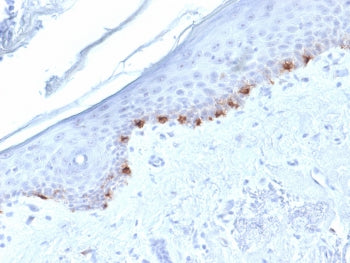 TRP1 / Tyrosinase-Related Protein-1 Antibody
