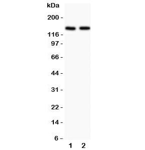 Western blot testing of Hamartin antibody and Lane 1: rat brain; 2: human HeLa lysate. Expected/obse
