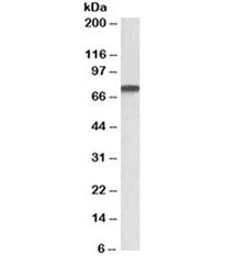 Western blot testing of A431 lysate with Progranulin antibody at 1ug/ml. Predicted molecular weight: