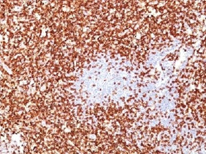 IHC testing of CD45RO antibody cocktail and FFPE human tonsil