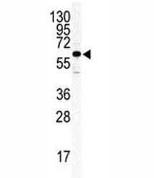 ILK2/ILK1 Antibody