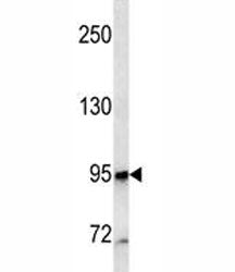 CD10 Antibody