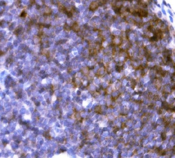 IHC staining of FFPE rat lymph node tissue with Cd19 antibody. HIER: boil tissue sections in pH8 EDT