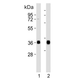 Western blot testing of human 1) Daudi and 2) Raji cell lysate with HLA-DQA1 antibody. Predicted mol