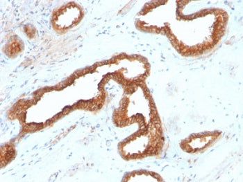 AMACR / p504S Antibody (Prostate Cancer Marker)