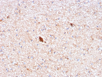 Serum Amyloid P Antibody
