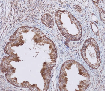 WFDC1 Antibody