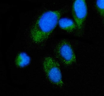 ALAS2 Antibody / ASB / 5-aminolevulinic acid synthase 2