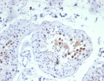 IHC staining of FFPE human testis tissue with KNSL6 antibody (clone KIF2C/6529) at 2ug/ml. HIER: boi