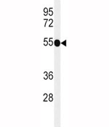 CD30 Antibody