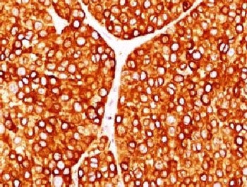 Tyrosinase Antibody