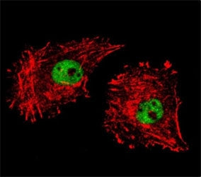 Confocal immunofluorescent analysis of FUS antibody with MDA-MB231 cells followed by Alexa Fluor 488