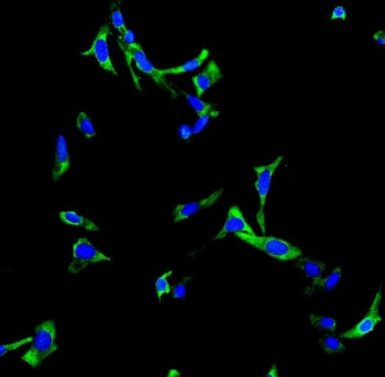 ChAT Antibody / Choline Acetyltransferase