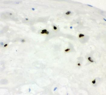 Cyclin E1 Antibody / CCNE1