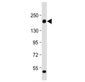 Western blot testing of THBS1 antibody at 1:2000 + human MDA-MB-231 cell lysate. Expected molecular 