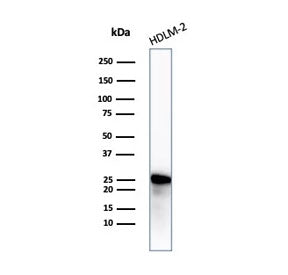 Western blot testing of human HDLM-2 cell lysate with recombinant Bcl-2 antibody. Predicted molecula