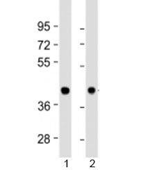 Western blot testing of human 1) heart and 2) brain lysate with BRCC36 antibody at 1:1000. Predicted
