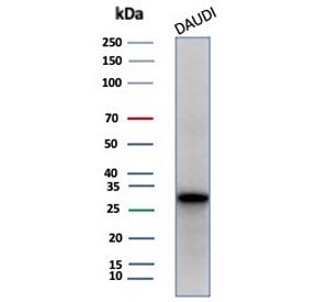 Western blot testing of human Daudi cell lysate with Haptoglobin (HP) antibody (clone HP/3834). Pred