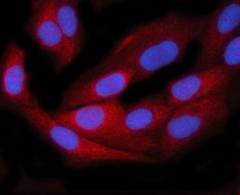 Immunofluorescent staining of FFPE human HeLa cells with TTC38 antibody (red) and DAPI nuclear stain