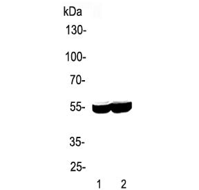 CYP2E1 Antibody
