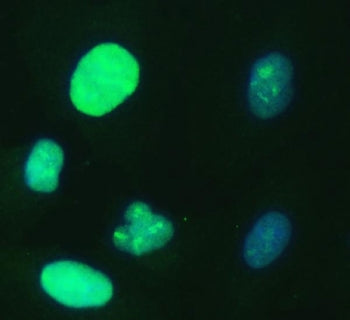 UBE2S Antibody