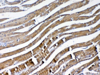 IHC testing of FFPE mouse heart tissue with VEGFB antibody at 1ug/ml. Required HIER: steam section i