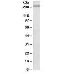 Western blot testing of mouse spleen lysate with Dennd4c antibody at 0.5ug/ml. Predicted molecular w