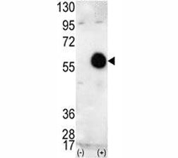 AKT2 Antibody