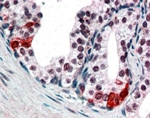SMARCE1 Antibody